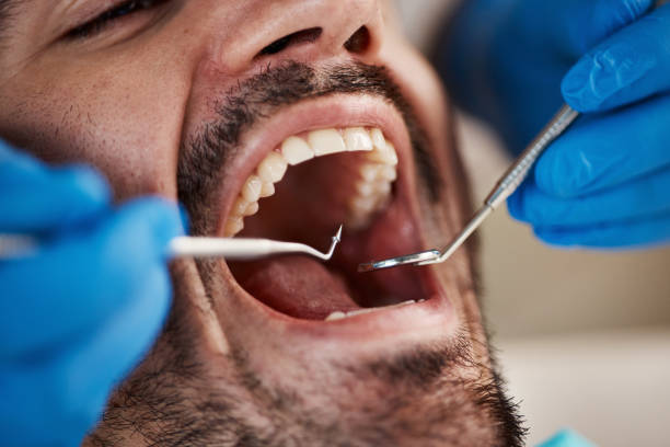 Best Emergency Dental Care  in Limestone, IL